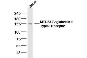 Mouse uterus lysates probed with MTUS1 Polyclonal Antibody, unconjugated  at 1:300 overnight at 4°C followed by a conjugated secondary antibody for 60 minutes at 37°C. (MTUS1 anticorps  (AA 1151-1270))