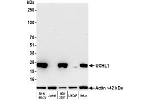 Western Blotting (WB) image for anti-Ubiquitin Carboxyl-terminal Esterase L1 (Ubiquitin Thiolesterase) (UCHL1) (AA 50-100) antibody (ABIN7449527)