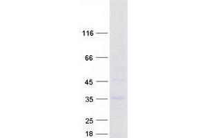 Validation with Western Blot