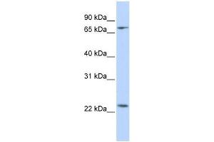 Western Blot showing ZNF185 antibody used at a concentration of 1-2 ug/ml to detect its target protein. (Zinc Finger Protein 185 anticorps  (N-Term))