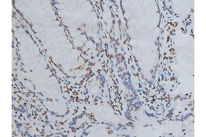ABIN6267039 at 1/200 staining human colon tissue sections by IHC-P. (Histone 3 anticorps)