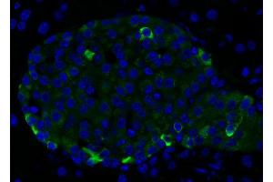 Immunohistochemistry (IHC) image for anti-Chromogranin B (Secretogranin 1) (CHGB) (AA 407-677) antibody (ABIN1742518) (CHGB anticorps  (AA 407-677))