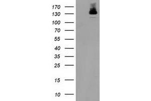 Western Blotting (WB) image for anti-Histone Deacetylase 6 (HDAC6) antibody (ABIN1498618)