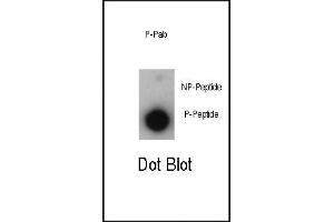 Dot blot analysis of anti-Phospho-P21CIP1-T57 Antibody (ABIN389613 and ABIN2839617) on nitrocellulose membrane. (p21 anticorps  (pThr57))