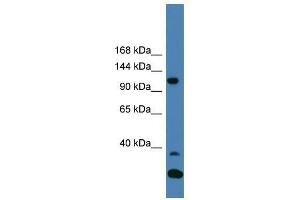 Western Blot showing TYK2 antibody used at a concentration of 1-2 ug/ml to detect its target protein. (TYK2 anticorps  (C-Term))