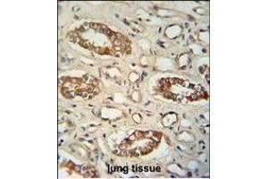 M1L antibody (C-term) (ABIN654954 and ABIN2844594) immunohistochemistry analysis in formalin fixed and paraffin embedded human lung tissue followed by peroxidase conjugation of the secondary antibody and DAB staining. (PPM1L anticorps  (C-Term))