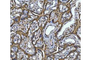 IHC analysis of Annexin A10/ANXA10 using anti-Annexin A10/ANXA10 antibody (ABIN7601853). (Annexin a10 anticorps  (AA 49-324))