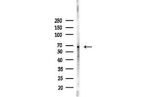 Western blot analysis of lysates from Hela cells(heat-shock,45 min treatment), using Phospho-Tau (Ser416)[Ser733] Antibody at 1/1000 dilution.