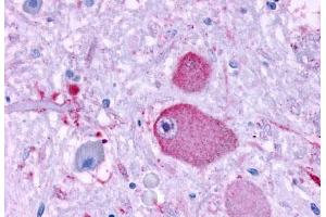Anti-GPR37 antibody  ABIN1048808 IHC staining of human brain, neurons and glia. (GPR37 anticorps  (N-Term))