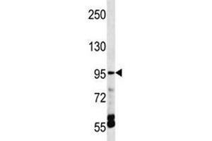 TRPV5 antibody western blot analysis in HepG2 lysate. (TRPV5 anticorps  (AA 634-663))