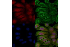 ABIN6256394 and ABIN6267617 staining Hela cells(20 min of 30uM Forskolin treatment) by IF/ICC. (PKC delta anticorps  (pSer645))