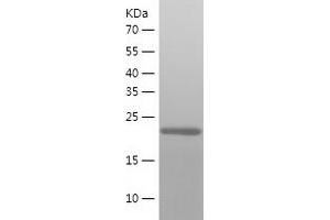 Western Blotting (WB) image for Integrin beta 1 Binding Protein 3 (ITGB1BP3) (AA 1-230) protein (His-IF2DI Tag) (ABIN7123471)