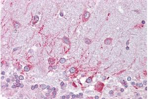 Immunohistochemistry with Brain, cerebellum tissue at an antibody concentration of 5µg/ml using anti-PSEN1 antibody (ARP44201_P050)