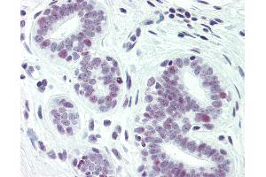 Anti-PAX2 antibody IHC of human breast. (PAX2A anticorps  (pSer393))