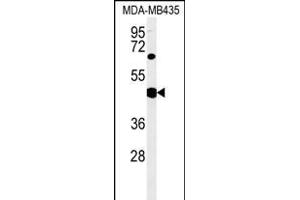 SH2D2A Antibody (Center) (ABIN651523 and ABIN2840277) western blot analysis in MDA-M cell line lysates (35 μg/lane). (SH2D2A anticorps  (AA 86-112))