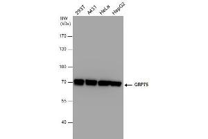 WB Image GRP75 antibody detects GRP75 protein by western blot analysis. (HSPA9 anticorps  (Center))