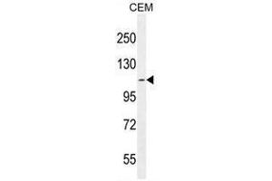 AT8B2 Antibody (N-term) western blot analysis in CEM cell line lysates (35µg/lane). (ATP8B2 anticorps  (N-Term))