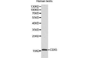 Western Blotting (WB) image for anti-Lysozyme-Like 6 (LYZL6) (AA 20-148) antibody (ABIN3021348) (LYZL6 anticorps  (AA 20-148))