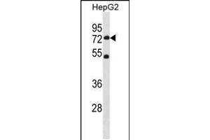 Western blot analysis in HepG2 cell line lysates (35ug/lane). (SETD3 anticorps  (C-Term))