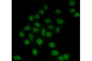 Immunofluorescence analysis of MCF7 cells using TE antibody (ABIN6129488, ABIN6148982, ABIN6148984 and ABIN6217332).