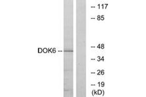 Western blot analysis of extracts from COLO cells, using DOK6 Antibody. (DOK6 anticorps  (AA 111-160))