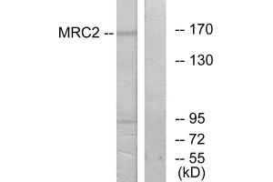 Western Blotting (WB) image for anti-Mannose Receptor, C Type 2 (MRC2) (N-Term) antibody (ABIN1850036)