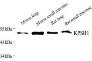 Western blot analysis of PSKH1 (ABIN7075291),at dilution of 1: 1500,Lane 1: Mouse lung tissue lysate,Lane 2: Mouse small intestine tissue lysate,Lane 3: Rat lung tissue lysate,Lane 4: Rat small intestine tissue lysate (PSKH1 anticorps)