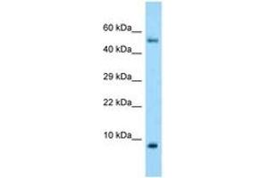 Image no. 1 for anti-S100 Calcium Binding Protein A10 (S100A10) (C-Term) antibody (ABIN6748414) (S100A10 anticorps  (C-Term))