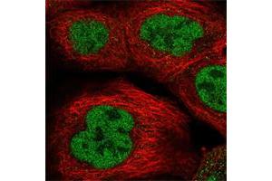 Immunofluorescent staining of human cell line A-431 shows positivity in nucleus but not nucleoli. (RREB1 anticorps)