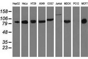 Western blot analysis of extracts (35 µg) from 9 different cell lines by using anti-DGKB monoclonal antibody. (DGKB anticorps)