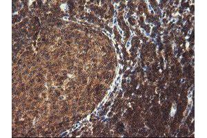 Image no. 6 for anti-Tripartite Motif Containing 44 (TRIM44) antibody (ABIN1501505) (TRIM44 anticorps)