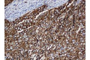 Image no. 11 for anti-SERPINE1 mRNA Binding Protein 1 (SERBP1) (AA 1-262) antibody (ABIN1490675)