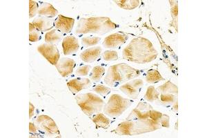 Immunohistochemistry of paraffin embedded mouse Skeletal muscle using Igfn1 (ABIN7074278) at dilution of 1:700 (400x lens)