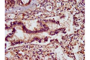 anti-Signal Peptide, CUB Domain, EGF-Like 2 (SCUBE2) (AA 534-703) antibody