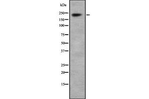 Western blot analysis Na+ CP type I alpha using HepG2 whole cell lysates (SCN1A anticorps  (Internal Region))