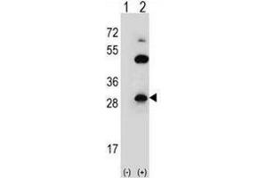 Western blot analysis of CLDN2 (arrow) using rabbit polyclonal CLDN2 Antibody (pTyr224) . (Claudin 2 anticorps  (C-Term))