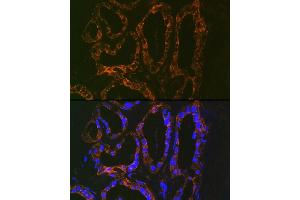 Immunofluorescence analysis of human thyroid using Parathyroid Hormone (PTH) (PTH) Rabbit mAb (ABIN7269175) at dilution of 1:100 (40x lens).