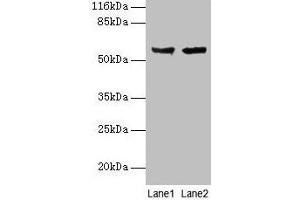 Western blot All lanes: CYP17A1 antibody at 2 μg/mL Lane 1: Hela whole cell lysate Lane 2: A549 whole cell lysate Secondary Goat polyclonal to rabbit IgG at 1/10000 dilution Predicted band size: 58 kDa Observed band size: 58 kDa (CYP17A1 anticorps  (AA 1-508))