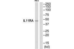Western Blotting (WB) image for anti-Interleukin 11 Receptor, alpha (IL11RA) (C-Term) antibody (ABIN1852556)