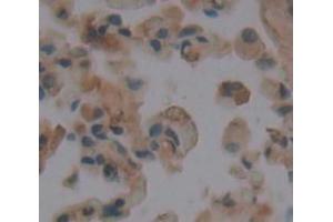 IHC-P analysis of Human Tissue, with DAB staining. (TPSB2 anticorps  (AA 35-275))