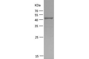 Western Blotting (WB) image for Ring Finger Protein 11 (RNF11) (AA 2-154) protein (GST tag) (ABIN7124912) (RNF11 Protein (AA 2-154) (GST tag))