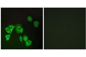 Immunofluorescence analysis of A549 cells, using TTF2 antibody. (TTF2 anticorps  (Internal Region))
