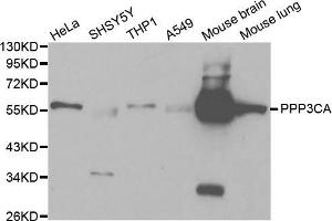 Western blot analysis of extracts of various cell lines, using PPP3CA antibody (ABIN5970422) at 1/1000 dilution. (PPP3CA anticorps)