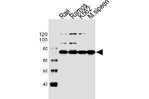Western blot analysis of lysates from Raji, Ramos, K562 cell line and mouse spleen tissue lysate(from left to right), using BTK Antibody (Center) (ABIN6243554 and ABIN6577451). (BTK anticorps  (AA 396-430))