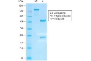 SDS-PAGE Analysis Purified IgG4 Recombinant Rabbit Monoclonal Antibody (IGHG4/2042R). (Recombinant IGHG4 anticorps)