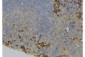 ABIN6273660 at 1/100 staining Human lymph node tissue by IHC-P. (IL-6 Receptor anticorps  (N-Term))