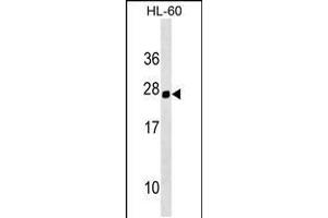 Western blot analysis in HL-60 cell line lysates (35ug/lane). (Homeobox C5 anticorps  (C-Term))