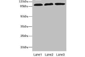Western blot All lanes: CD97 antibody at 3. (CD97 anticorps  (AA 240-435))
