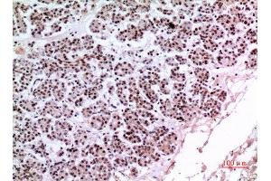 Immunohistochemistry (IHC) analysis of paraffin-embedded Human Pancreas, antibody was diluted at 1:100. (KLF13 anticorps)