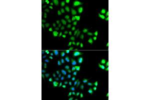 Immunofluorescence analysis of A549 cell using SUMO4 antibody. (SUMO4 anticorps)